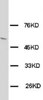 Anti-Glucose Transporter GLUT4/SLC2A4 Antibody