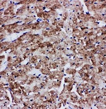 Anti-Glucose Transporter GLUT4/SLC2A4 Antibody