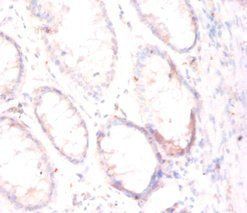FOLH1 Antibody