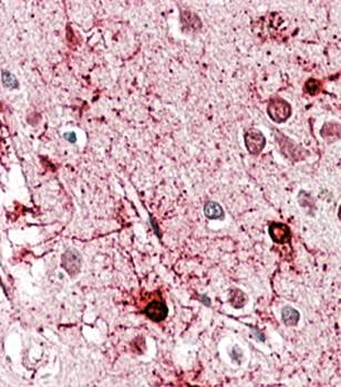 Goat anti-Glutamate Dehydrogenase Antibody
