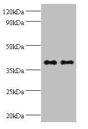 Glutaminyl-peptide cyclotransferase antibody