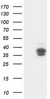 Glutathione S Transferase theta 2 Antibody