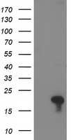 Glutathione S Transferase theta 2 Antibody