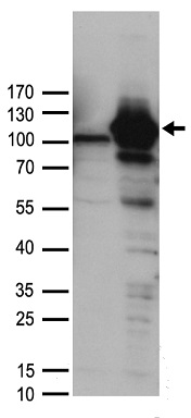 GSTZ1 Antibody