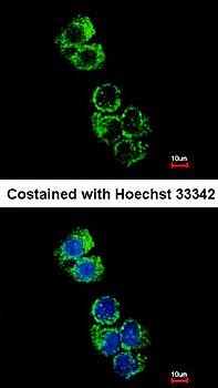glutathione S-transferase alpha 2 Rabbit Polyclonal Antibody