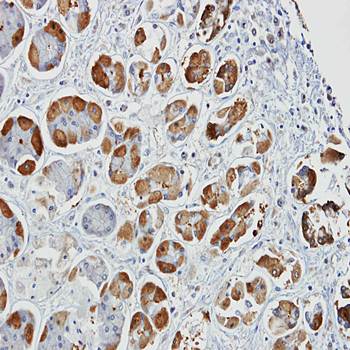 glutathione S-transferase alpha 2 Rabbit Polyclonal Antibody