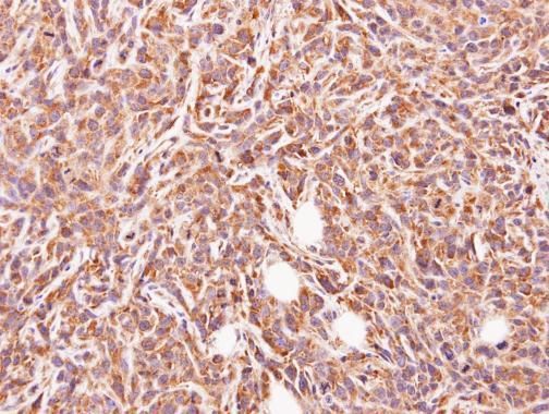 GLYATL1 antibody