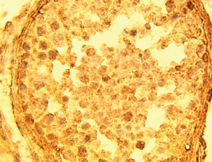 Rabbit Human Glyceraldehyde-3-phosphate dehydrogenase (GAPDH) Antibody