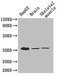 Glyceraldehyde-3-phosphate dehydrogenase antibody