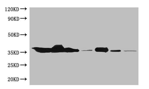 Glyceraldehyde-3-phosphate dehydrogenase antibody