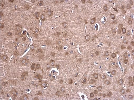 Glycine dehydrogenase antibody [N3C2-2], Internal