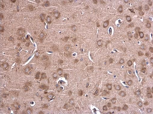 Glycine dehydrogenase antibody