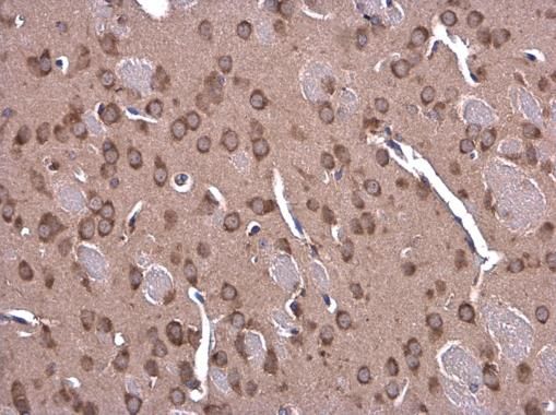 Glycine dehydrogenase antibody [N3C2-2], Internal