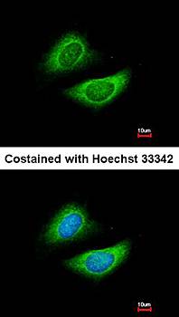 glycine dehydrogenase (decarboxylating) precursor antibody