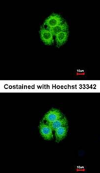 glycine-N-acyltransferase-like 1 antibody