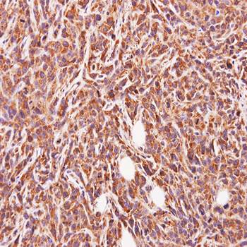 glycine-N-acyltransferase-like 1 antibody
