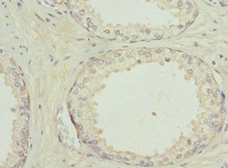 Glycogen phosphorylase, brain form antibody