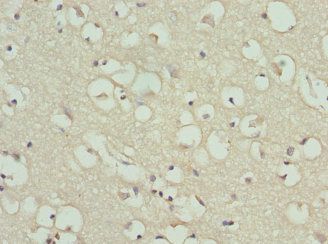 PYGB Antibody
