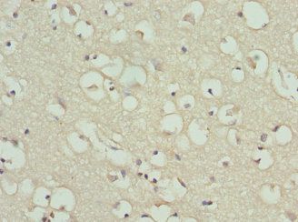 Glycogen phosphorylase, brain form antibody