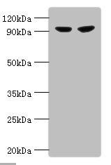 Glycogen phosphorylase form antibody