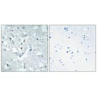 GLYCTK Antibody