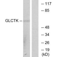 GLYCTK Antibody