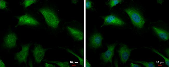 Glyoxalase I Rabbit Polyclonal Antibody