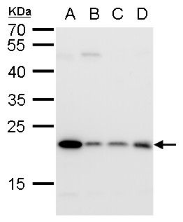 Glyoxalase I Rabbit Polyclonal Antibody