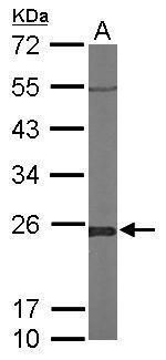 Glyoxalase I Rabbit Polyclonal Antibody