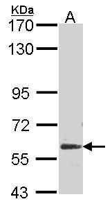 malic enzyme 1 Antibody