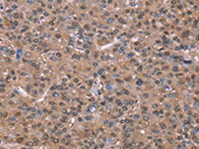 GLYR1 Antibody