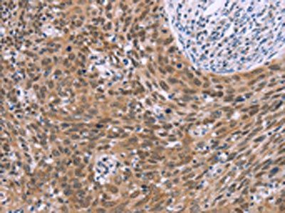 GLYR1 Antibody