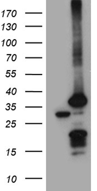 GM CSF Antibody