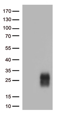GM CSF Antibody