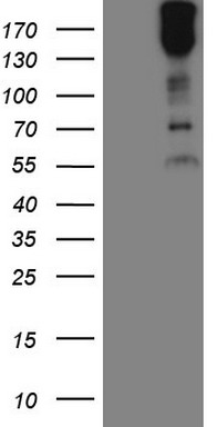 GM CSF Antibody