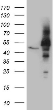 GM CSF Antibody
