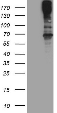GM CSF Antibody