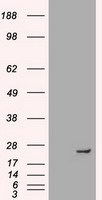 GM CSF Receptor alpha Antibody