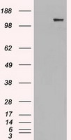 GM CSF Receptor alpha Antibody