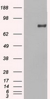 GM CSF Receptor alpha Antibody