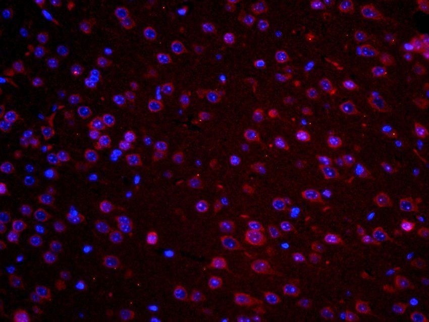 TGFR-2 Rabbit Polyclonal Antibody