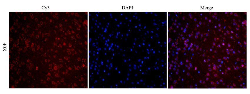 TGFR-2 Rabbit Polyclonal Antibody