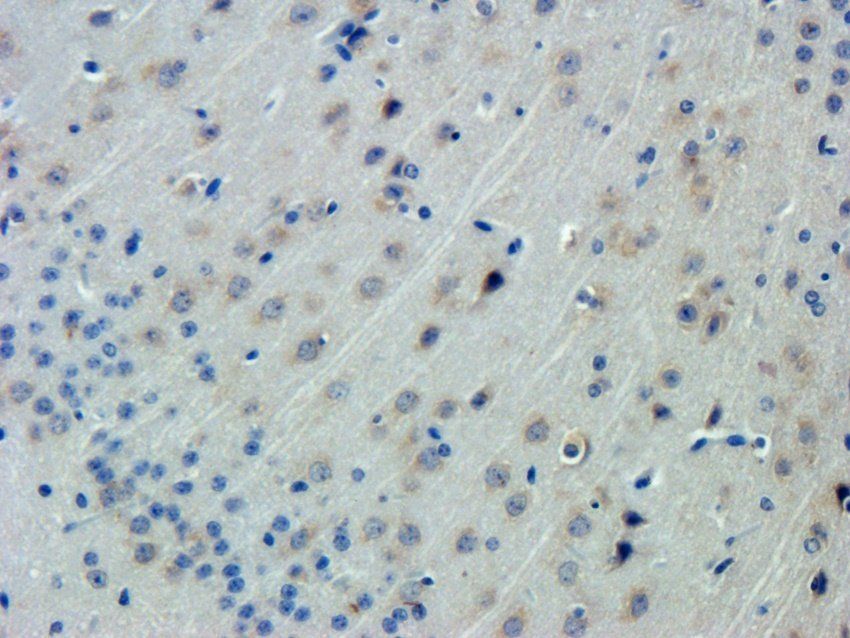 TGFR-2 Rabbit Polyclonal Antibody