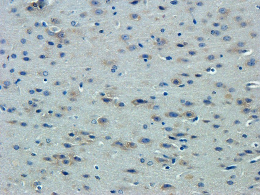 TGFR-2 Rabbit Polyclonal Antibody