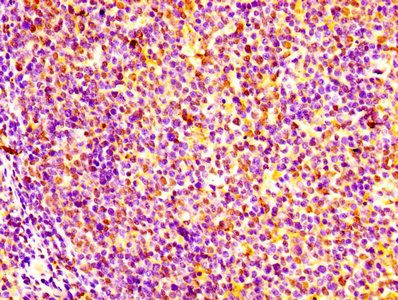 GM2A Antibody