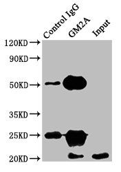 GM2A antibody