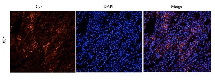 GMCSF antibody