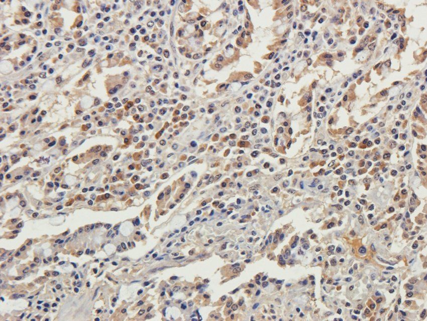 GMCSF antibody