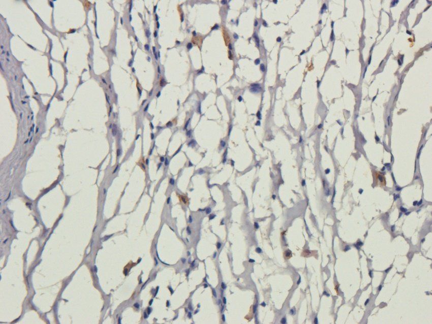 GMCSF antibody