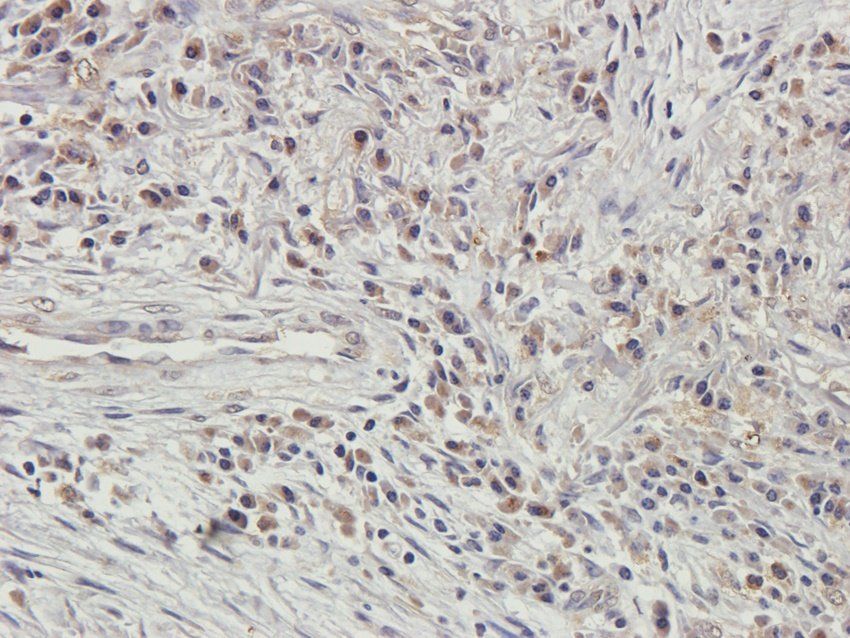 GMCSF antibody